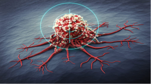 Targeted Therapy